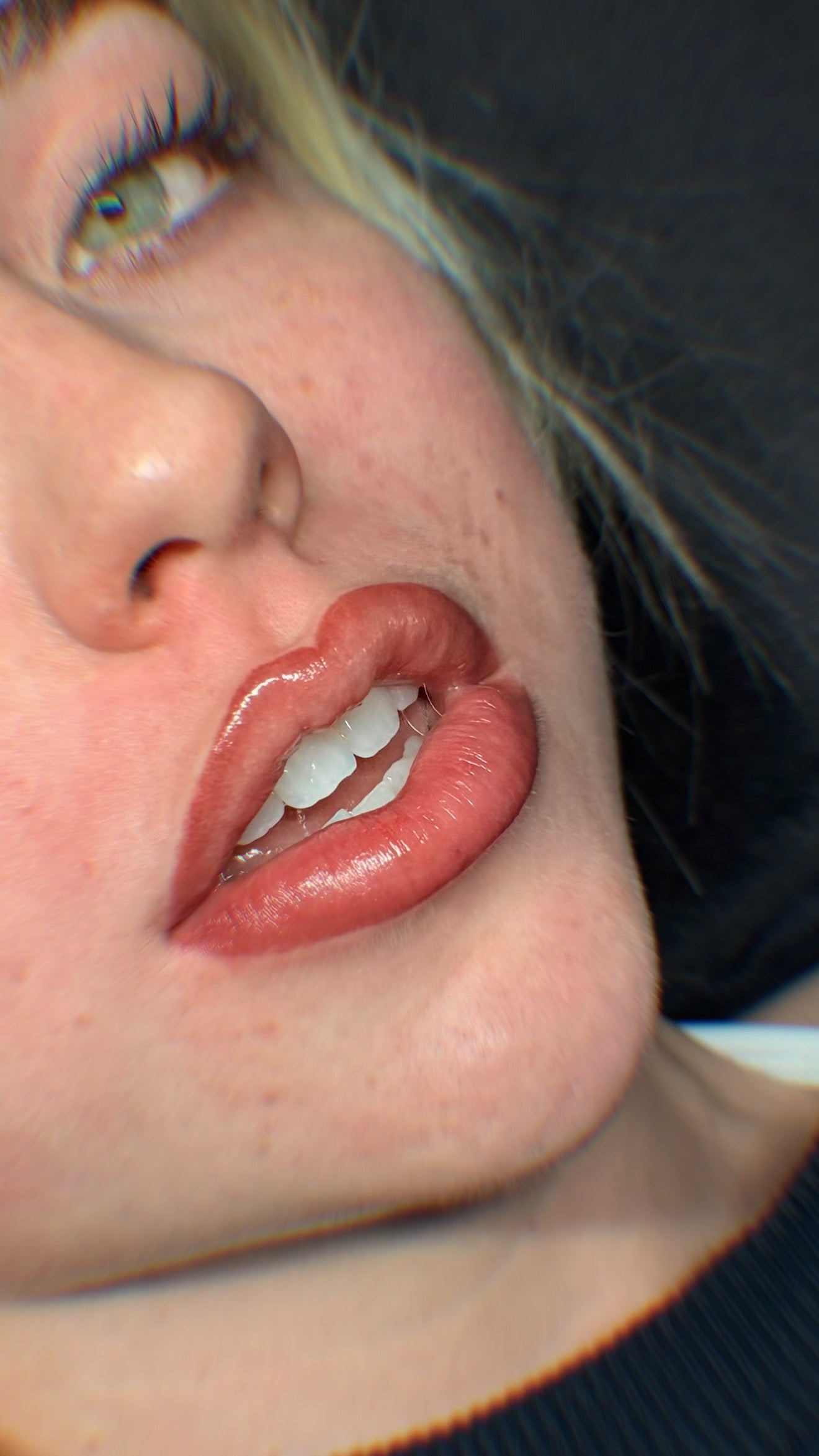 Micro-pigmentation - lip blush