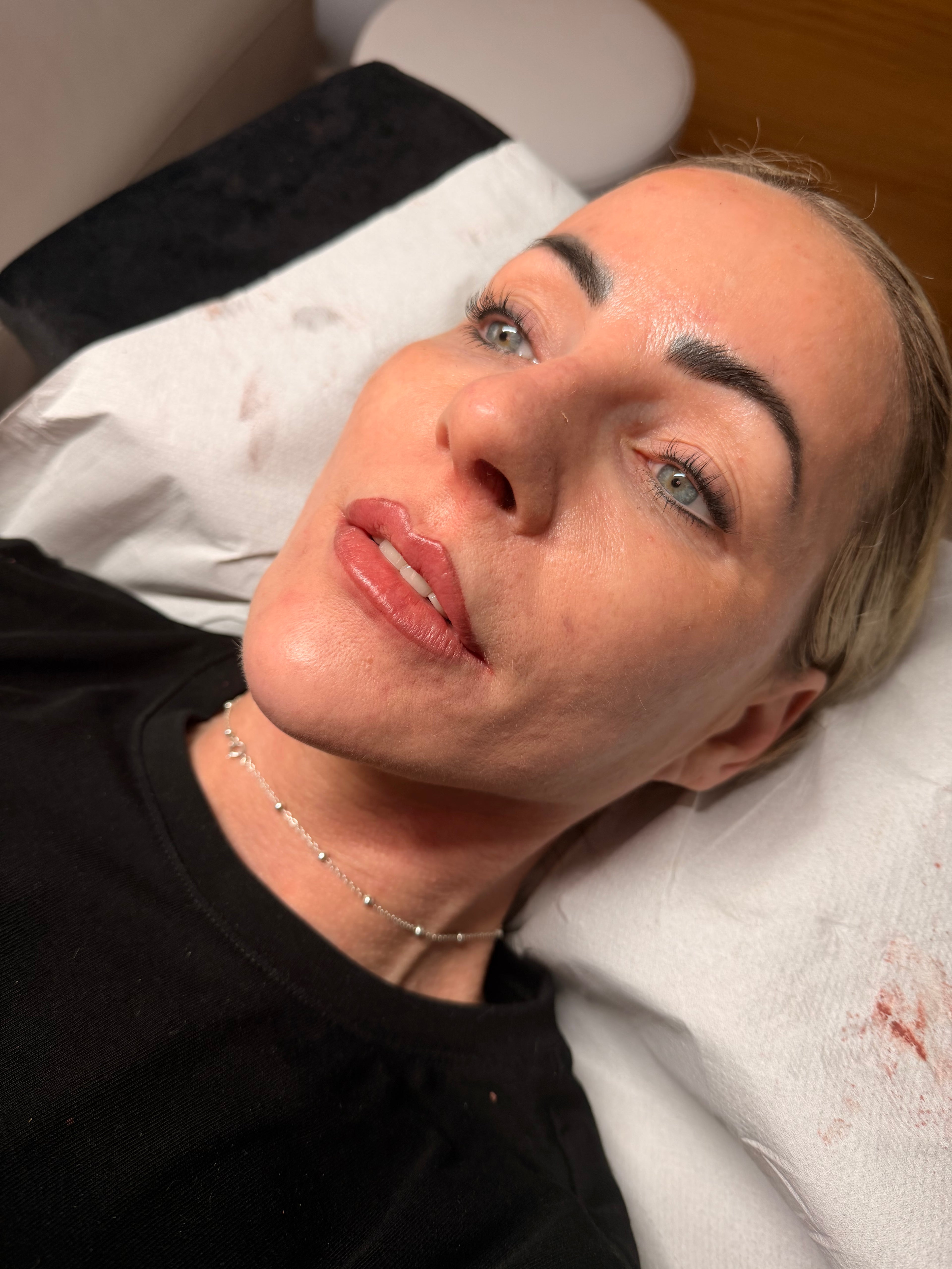 Micro-pigmentation - lip blush