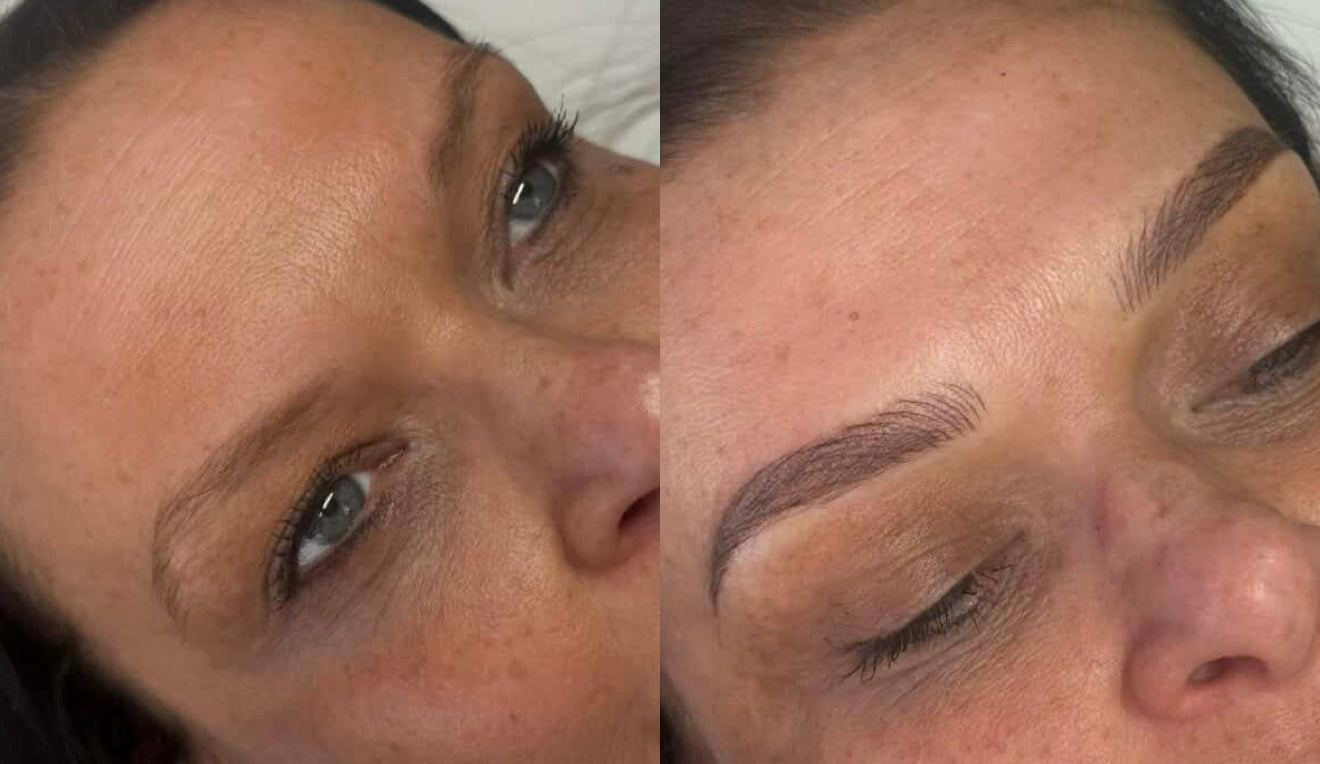 Micro-pigmentation - eyebrows