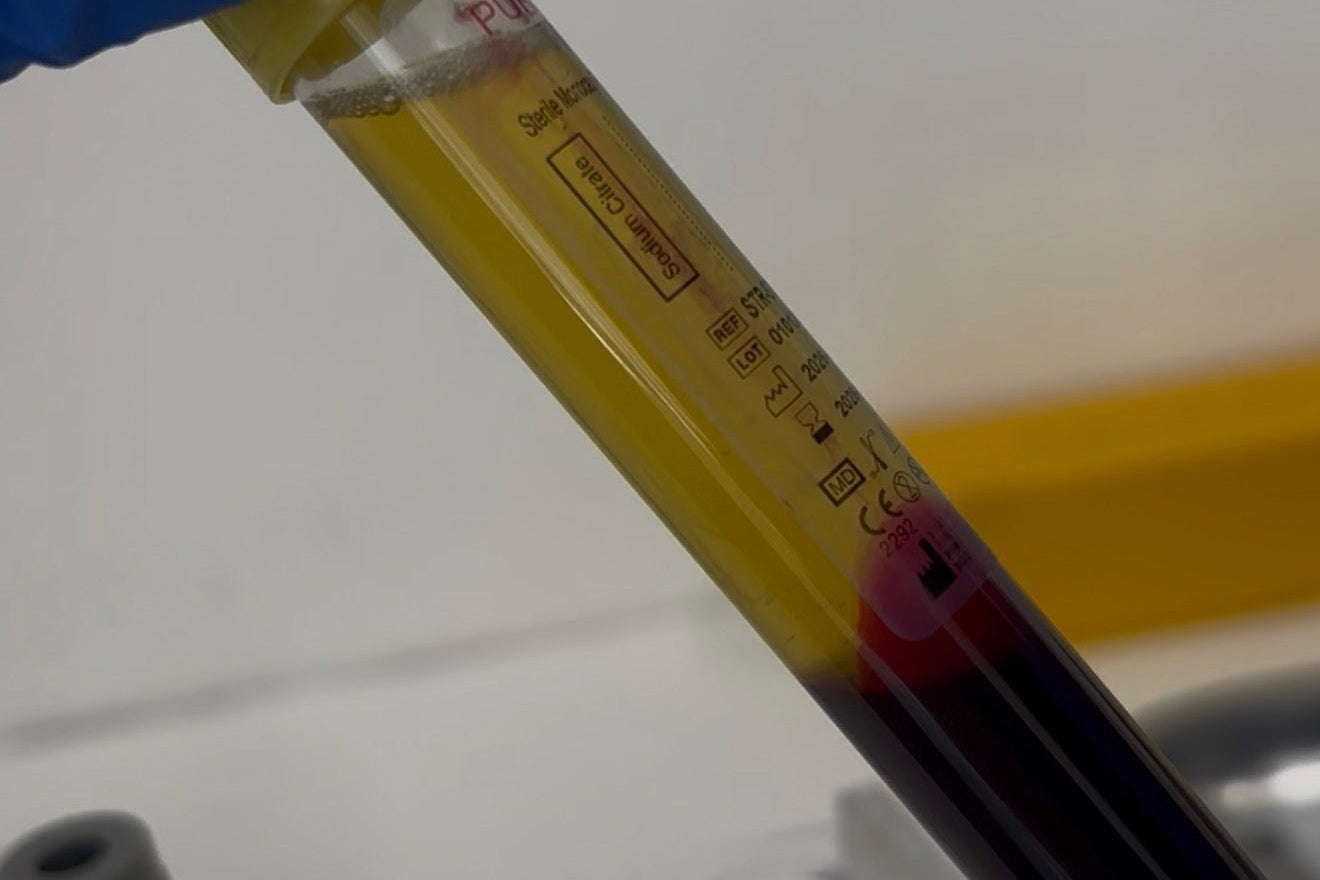 PRP