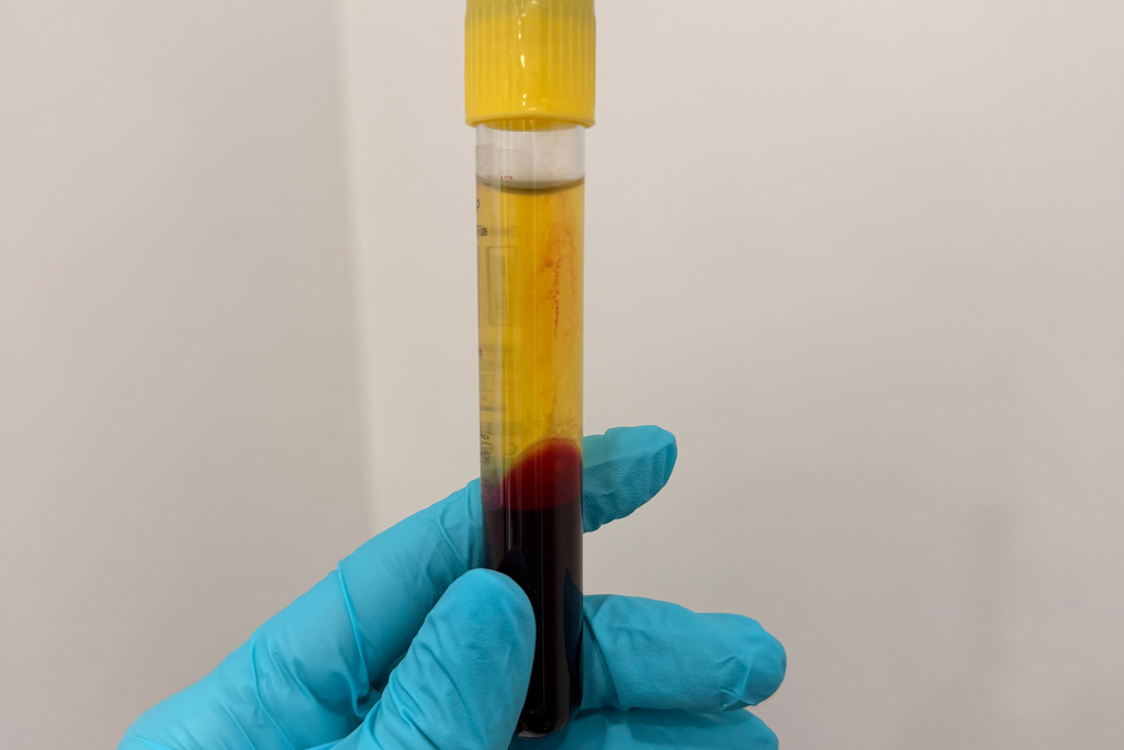 PRP